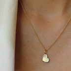 Open Heart